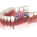 서울우이치과의원 이미지