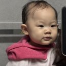 김종림 | 오체안성형외과 대전점 / 12개월 아기 선천성피지선모반 수술병원선택