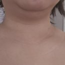 아르떼뷰티 하단점