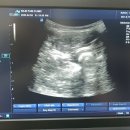 BS메디칼 이미지