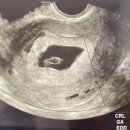 자애산부인과의원 이미지