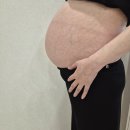 연세와병원 | 태동 사라짐 원인은 양수량 주수보다 큰 아기 원주 연세봄 산부인과 서브병원 후기