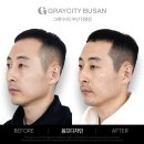 이제 부산 | 부산smp두피문신 내돈내산 후기 왜 이제 했나 싶어요