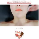 송원우 | 광교 경락 잘하는 곳 예플 광교점 윤곽관리 후기