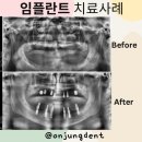 온정치과의원 이미지