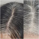 경동약국 | 젊음을 되찾는 방법 - 청량리 탈모 커버 SMP &#39;뉴데이&#39; 후기