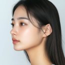 케이아트성형외과의원 | 이마 볼륨 주사, 종류보다 중요한 것은 ‘이마 전체 구조의 조화’