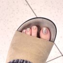 대신바른본의원 | 미즈슬림의원 발톱무좀 레이저 가격