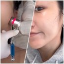 삭주로145번길2 | 다산피부관리 맛집 [ 고원장의 모공세척테라피 ] 모공세척 물방울관리 솔직 후기! +첫방문할인