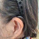 동구보청기 | 대전 동구 보청기 만족 후기