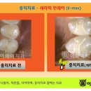 이화치과기공소 이미지
