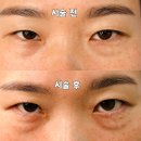 팔용로 | 팔용동속눈썹펌 잘하는 곳, 뜌뷰티샵 KOK 시그니처 블랙펌 후기
