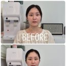 울산 윤곽관리 잘 하는 곳 예비신부 웨딩관리 에스테틱 추천, 챠밍에스테틱