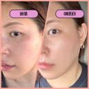 동국카 | 올리브영 진정크림 추천 센텔리안24 마데카 크림 마스크팩 후기