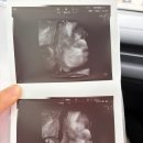 의사로43번길 | 충남 홍성군 임산부 및 배우자 백일해주사 무료 접종 지원 :: 홍성 임산부혜택