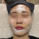 비슬타워 북편 | 대구피부관리_730 스킨 재방문 후기(피부 환절기 관리 케어는 여기서)