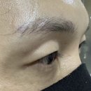 미병원 | 압구정 자연눈썹 | 미병원 블루컨투어에서 내돈내산 후기