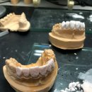 수인치과기공소 이미지