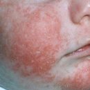 신라한의원 이미지