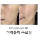 美쌩얼 | 구로 피부관리 :: 기미 잡티 제거 미백 솔직후기