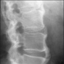 초이스병원 이미지