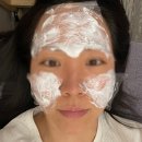 티엠바이오 | 종근당바이오 티엠버스보톡스 강남피부과에서 스킨부스터 받은 솔직후기