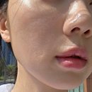 (주)원메디코 | 저자극 약산성 폼클렌징 추천 역대급 촉촉한 메디솝 버블클렌저