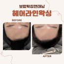 썬헤어라인 | 중랑구왁싱 / 면목동왁싱[보람왁싱앤태닝] 웨딩관리 헤어라인+구렛나루왁싱 후기