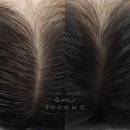 출산 후 한 움큼씩 빠지는 머리카락, 성남 산후탈모관리로 2달 만에 바뀐 일상
