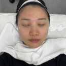 메디버디 | 부산 서면 고유메디스킨 내돈내산 필링 솔루션 후기