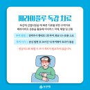 각골로 76 이미지