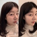 야간)생활도예 | 대구피부과 온다리프팅 내돈내산 솔직 후기 60kj