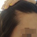 아리따움헤어라인