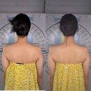 장유농협 앞　 | &lt;김해&gt; 장유에스테틱 미라클페이스디자인 JH윤곽술 후기 / 미선에스테틱