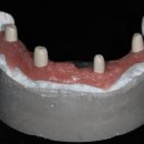 엘리트치과기공소 이미지