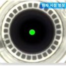 스마일약국 | 스마일라식 일기(2) :: 인천 부평안과 검진 및 당일수술 후기(ATOS, 스마트라식)