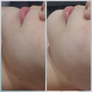 (주)자연드림 광주일곡점 | 광주피부관리 올가드림뷰티에서 받은 모공디톡스 후기✨