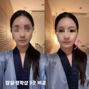 잠실 경락샵 내돈내산 | 3곳 비교 후 정착한 금단비가 잠실점 작은얼굴관리 후기