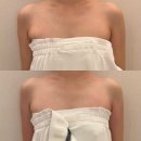 청담에스테틱 추천 디유에스테틱 프리베 청담 여름맞이 팔관리 후기