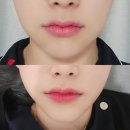 라미홈케어 | [뷰앤블루] 샵 피부관리 대신 선택한 뷰앤블루 EMS 원케어 마사지기, 얼굴 윤곽 비대칭 홈케어 리얼 후기