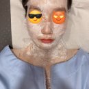 홍제한의원 | 편평사마귀 300개 역대급 많이 뺀 후기 / 서울 은평구 홍제역 홍제온한의원 편평사마귀 성지 추천