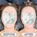 의병로 | 스페이스뷰티 의령점 의령 체형관리 전후 비교 리얼후기