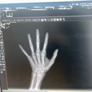 키즈앤하이성장의원 | 잠실 키앤키즈 성장클리닉 진료 후기 - 성장판 검사 및 예상키 확인하기