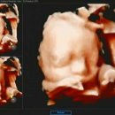 리움여성의원 이미지