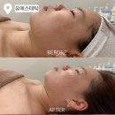 안유에스테틱(An:u Aesthetic) | 구미 상모사곡피부관리 추천! | 구미에스테틱 유에스테틱 리얼 후기 🫧