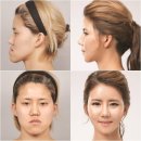 렛미인 - 영덕군 | 렛미인