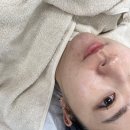 아쿠아폴리스 | 단스킨 동탄 아쿠아필 여드름관리 후기
