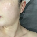 대구 동구 피부관리샵 수연테라피ㅣ수분팡팡 관리 후기