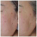 정관이지더원2차남자경로당 | [공지] 아로마 테라피 후기