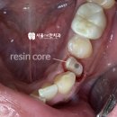 CORE 치과기공소 이미지